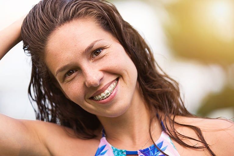 Woman laying on ground with clear braces