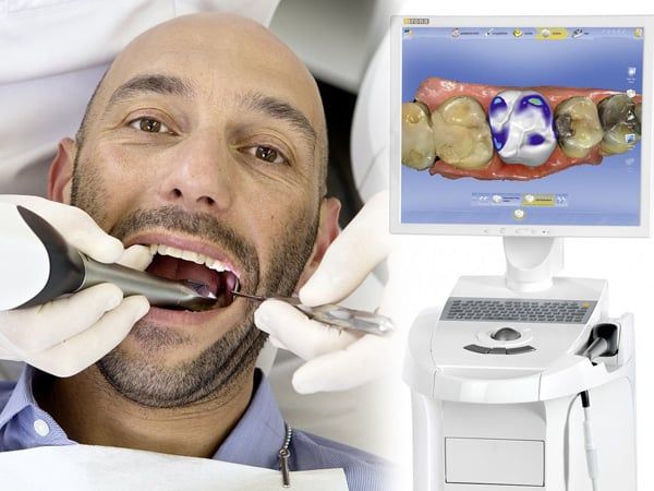CEREC Omnicam
