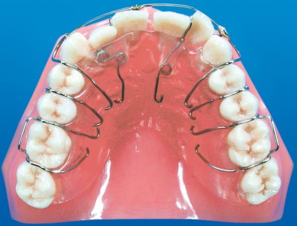 Multi-Spring Appliance